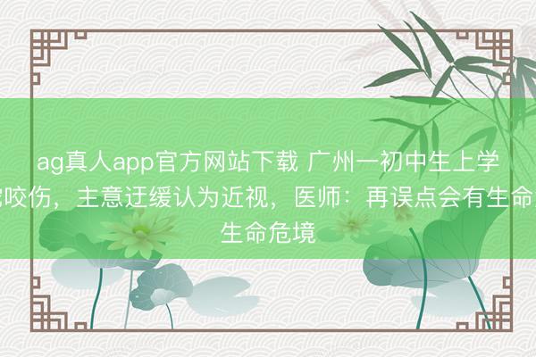 ag真人app官方网站下载 广州一初中生上学被蛇咬伤，主意迂缓认为近视，医师：再误点会有生命危境